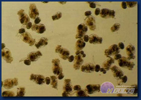 Rotifers